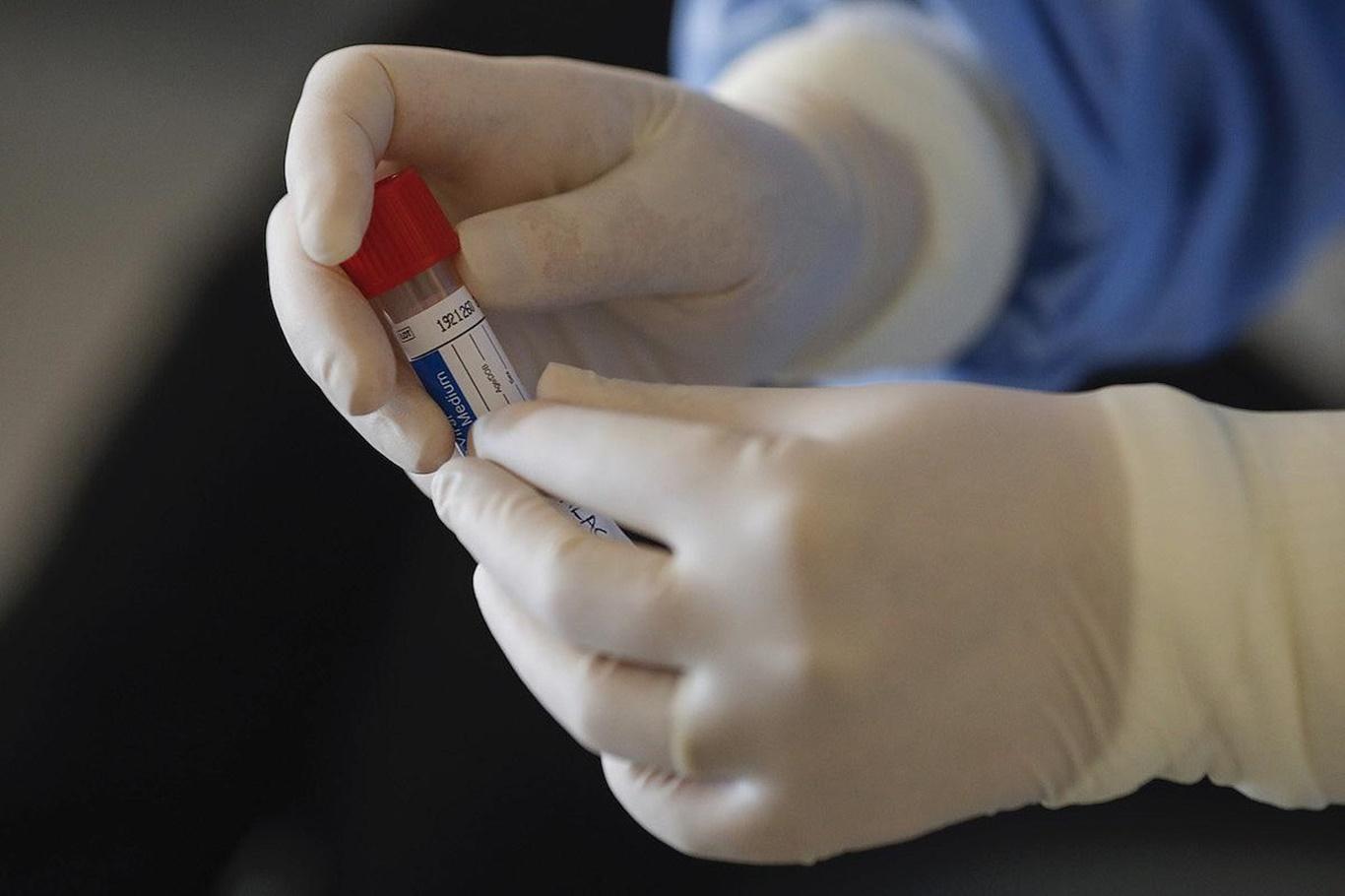 New York’ta Coronavirus vaka sayısı 162 bin kişiyi buldu